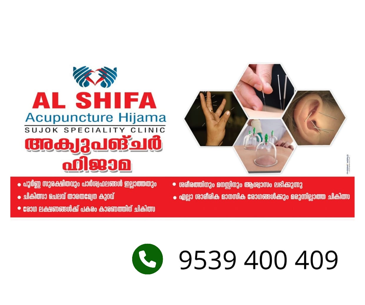 Al shifa Acupuncture Hijama Thurakkal Kondotty