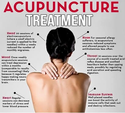 Al shifa Acupuncture Hijama Thurakkal Kondotty
